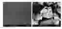 Fig. 01 - Nanocrystal Microparticles of Poorly Soluble Drugs and Methods of Production and Use Thereof