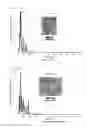 Fig. 04 - Polypeptide nano-bubbles and preparation method and application thereof