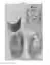 Fig. 06 - Coenzyme Q10 solubilizing composition and method for preparing same