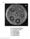 Fig. 03 - Antimicrobial composition containing 7,10-epoxyoctadeca-7,9-dienoic acid as active ingredient