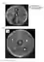Fig. 04 - Antimicrobial composition containing 7,10-epoxyoctadeca-7,9-dienoic acid as active ingredient