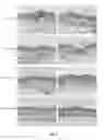 Fig. 07 - Topical formulations of PDE-4 inhibitors and their methods of use