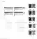 Fig. 14 - Methods and compositions for treating mesothelioma and small lung cancer that express midkine