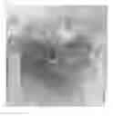 Fig. 04 - Compositions and methods for the treatment of skin lesions