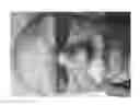 Fig. 08 - Compositions and methods for the treatment of skin lesions
