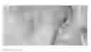 Fig. 12 - Compositions and methods for the treatment of skin lesions