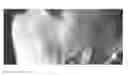 Fig. 15 - Compositions and methods for the treatment of skin lesions