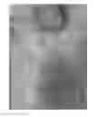 Fig. 19 - Compositions and methods for the treatment of skin lesions