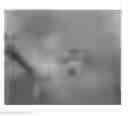 Fig. 22 - Compositions and methods for the treatment of skin lesions