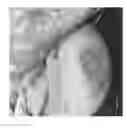 Fig. 26 - Compositions and methods for the treatment of skin lesions