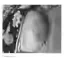 Fig. 27 - Compositions and methods for the treatment of skin lesions