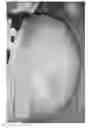 Fig. 28 - Compositions and methods for the treatment of skin lesions