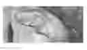 Fig. 30 - Compositions and methods for the treatment of skin lesions