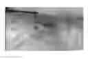 Fig. 33 - Compositions and methods for the treatment of skin lesions