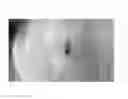 Fig. 37 - Compositions and methods for the treatment of skin lesions