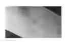 Fig. 43 - Compositions and methods for the treatment of skin lesions