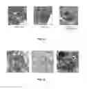 Fig. 09 - Liponucleotide-based therapy for ARDS