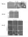 Fig. 09 - PROCESS FOR THE IDENTIFICATION OF COMPOUNDS FOR TREATING CANCER
