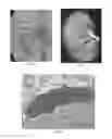 Fig. 02 - Polymeric treatment compositions