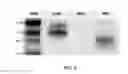 Fig. 08 - METHOD OF INHIBITING ANGIOGENESIS