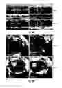 Fig. 09 - Compositions comprising extracellular matrix of primitive animal species and related methods