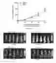 Fig. 16 - Compositions and methods for inhibiting tumor-induced immune suppression