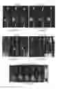 Fig. 22 - Compositions and methods for inhibiting tumor-induced immune suppression