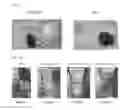 Fig. 11 - Statin-containing nanoparticle preparation for enhancing function of stem cells for treating inflammatory disease, and functionally enhanced stem cells containing same for treating inflammatory disease