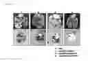 Fig. 22 - Complex of adenovirus and PAMAM-PEG-Erbitux, and use thereof