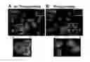 Fig. 01 - METHODS AND COMPOSITIONS FOR DETECTING ANEURYSMS