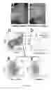 Fig. 06 - METHODS AND COMPOSITIONS FOR DETECTING ANEURYSMS