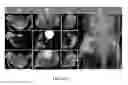 Fig. 07 - METHODS AND COMPOSITIONS FOR DETECTING ANEURYSMS