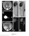 Fig. 08 - METHODS AND COMPOSITIONS FOR DETECTING ANEURYSMS