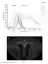 Fig. 02 - Radioligands for myelin