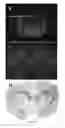 Fig. 09 - Radioligands for myelin
