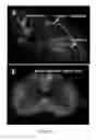 Fig. 10 - Radioligands for myelin