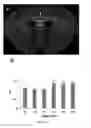 Fig. 11 - Radioligands for myelin