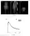 Fig. 12 - Radioligands for myelin