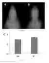 Fig. 13 - Radioligands for myelin