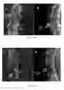 Fig. 14 - Radioligands for myelin