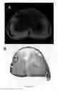 Fig. 16 - Radioligands for myelin