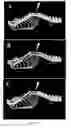 Fig. 17 - Radioligands for myelin