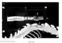 Fig. 18 - Radioligands for myelin