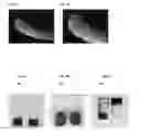 Fig. 06 - Hemostatic paste having surface enriched with hemostasis-promoting agents and devices for delivery