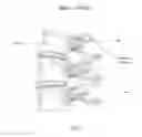 Fig. 08 - Intraoperative uses of settable surgical compositions
