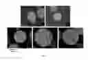 Fig. 04 - Bioactive glass-polymer composite bone scaffolds