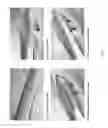 Fig. 02 - Method for producing an implantable ligament and tendon repair device
