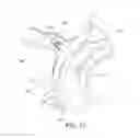 Fig. 28 - Ventricular assist assembly, system, and method