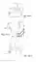 Fig. 45 - Delivery of respiratory therapy