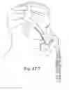 Fig. 71 - Delivery of respiratory therapy